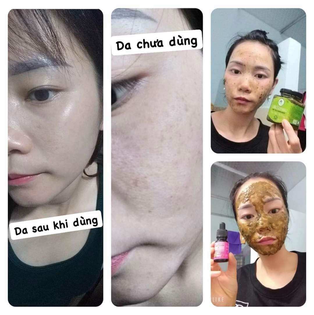 Cao Lá Rừng Tươi