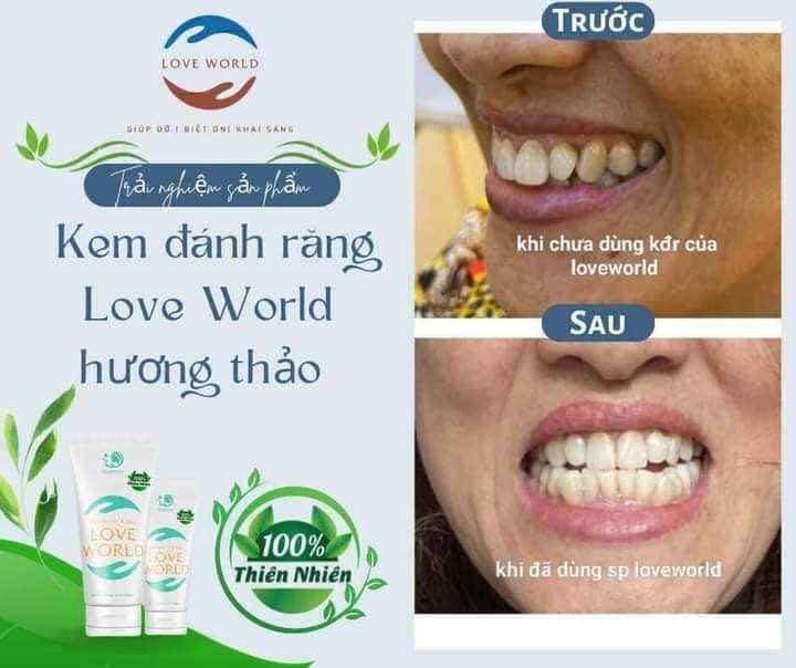 Kem Đánh Răng Thơm Miệng Trắng Răng Love World