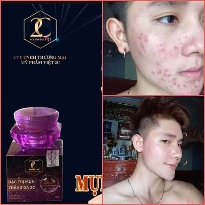 COMBO 5 HỘP KEM MỤN VÀ DƯỠNG DA 2C