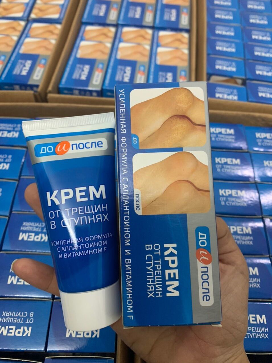 Kem nứt gót Kpem của Nga