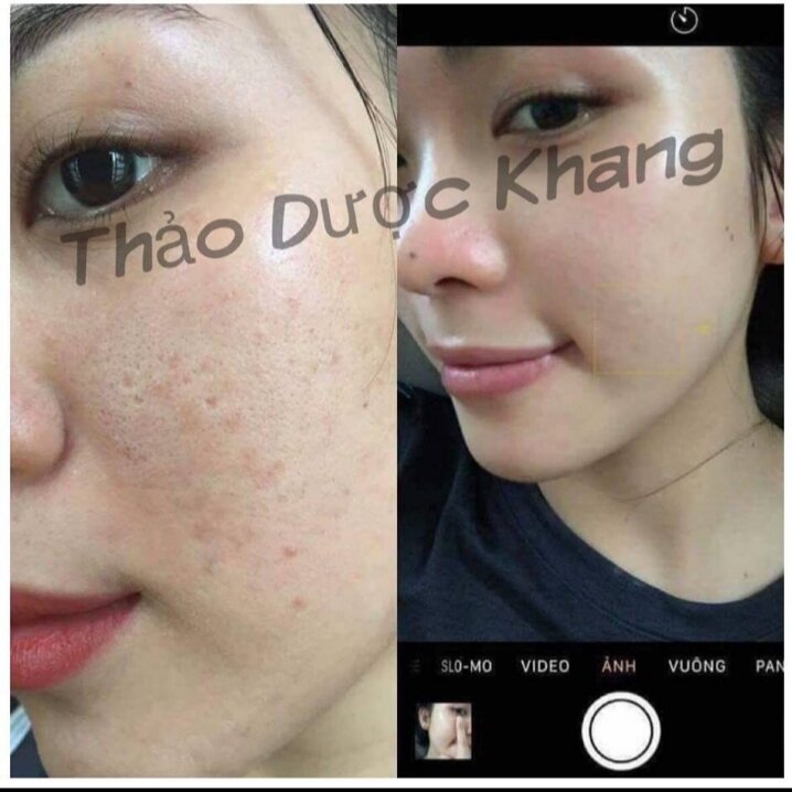 Bột Thảo Dược Chăm sóc da cao cấp - Thảo Dược Khang