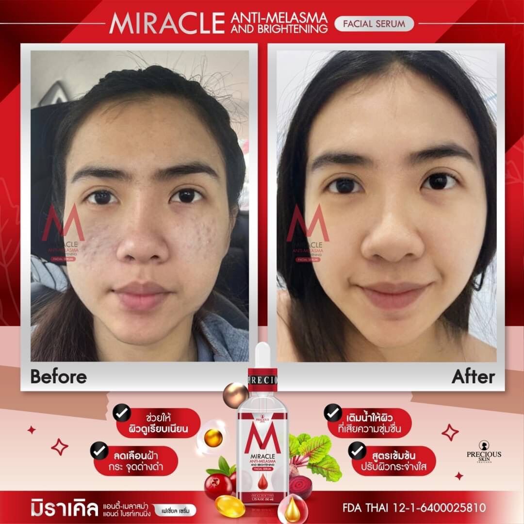 SERUM TÁI TẠO ngừa MỤN THÂM SẠM NÁM MIRACLE