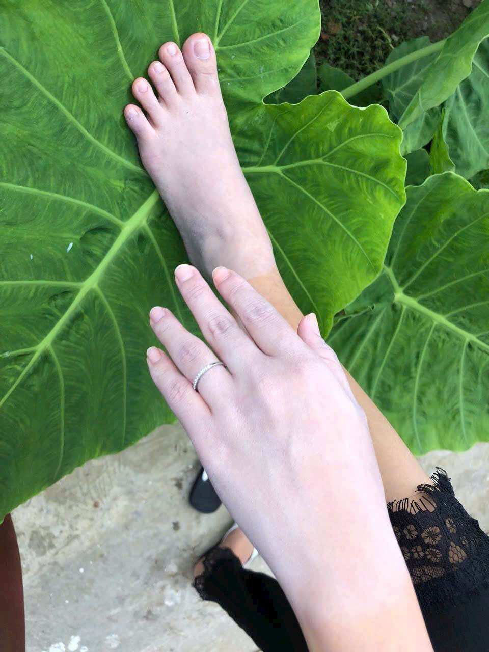 Tắm trắng lá nam