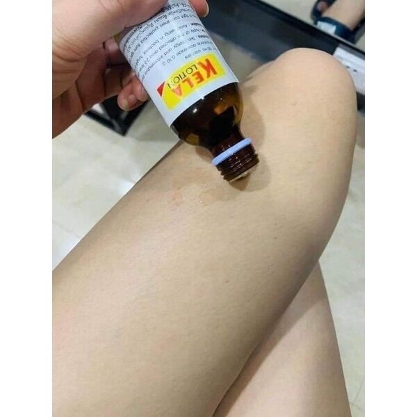 KELA LOTION DÀNH CHO VIÊM LỖ CHÂN LÔNG 60ML THÁI LAN