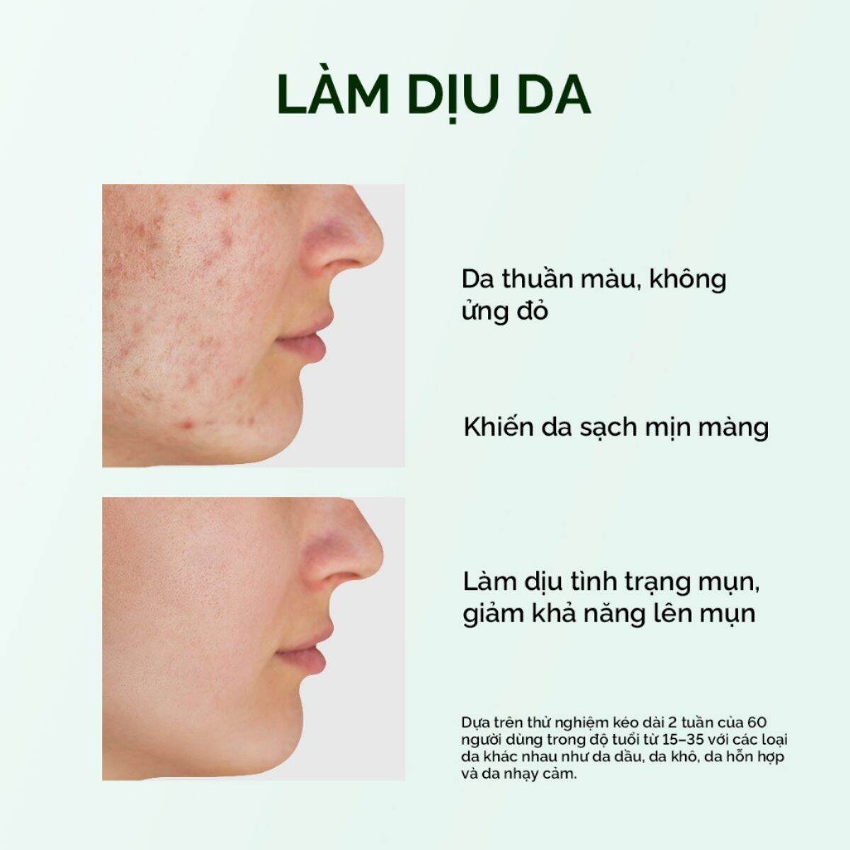 SKINTIFIC Thanh lăn mặt nạ đất sét ngải cứu giảm mụn đất sét Mugwort ANTI PORES & MẶT NẠ ĐẤT SÉT bùn MỤN Cấp ẩm Ngải Cứu 40g
