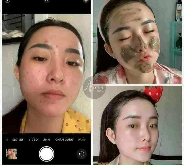 (Chính Hãng) Sữa Rửa Mặt Đông Y Nicos Thanh Nhi,
