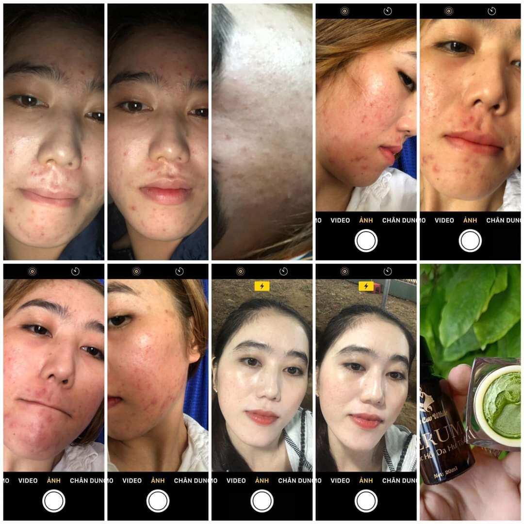 kem face trà xanh bích cao white