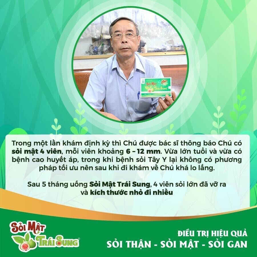 Sỏi mật sỏi thận trái sung