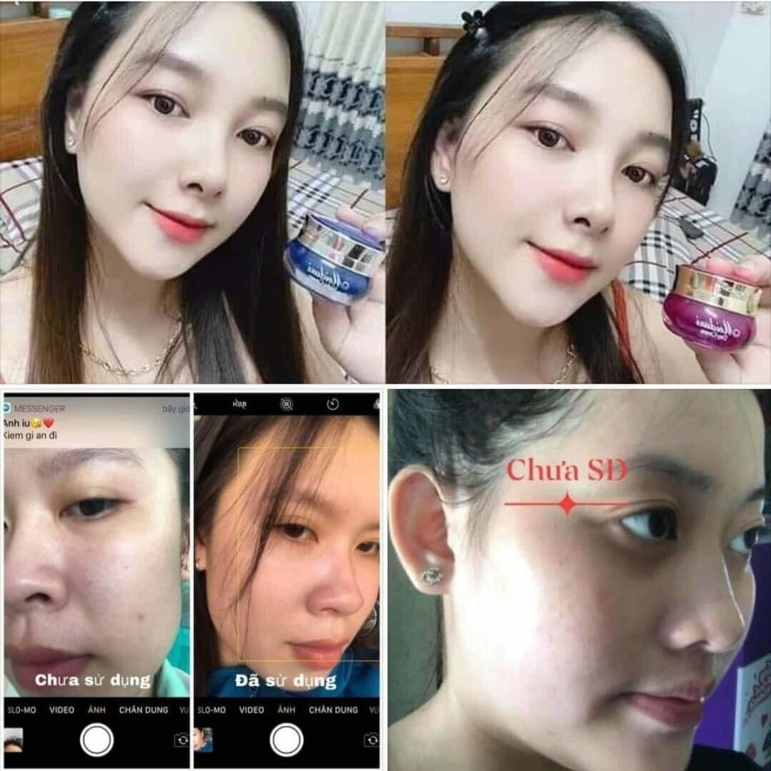 [Chính Hãng] Kem Nhật Meiduxi