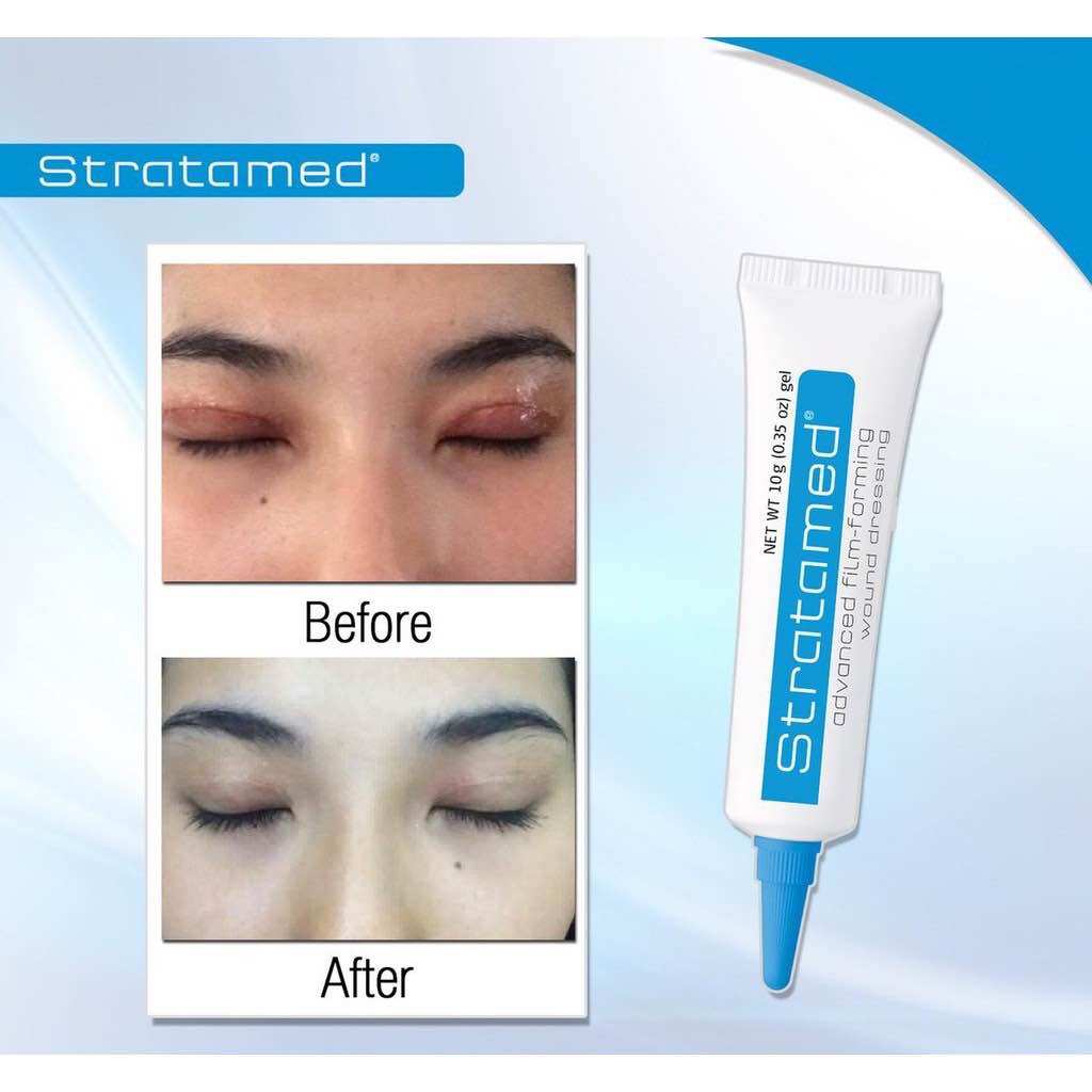 GEL MỜ SẸO HỞ STRATAMED
