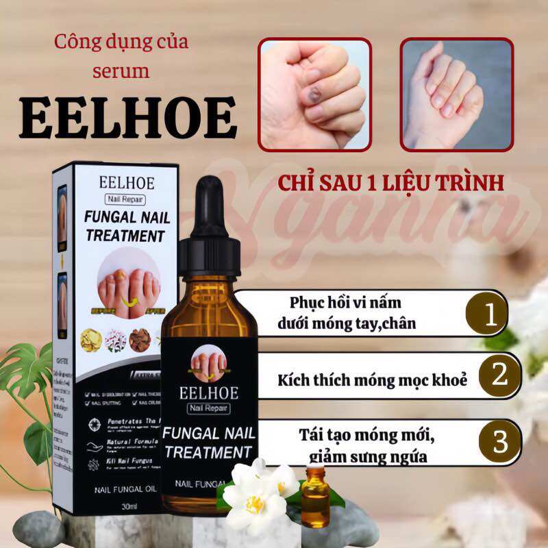  Tinh chất nấm móng Eelhoe Phục Hồi Móng Tay Chân Loại Bỏ Nấm Móng Nhập khẩu 