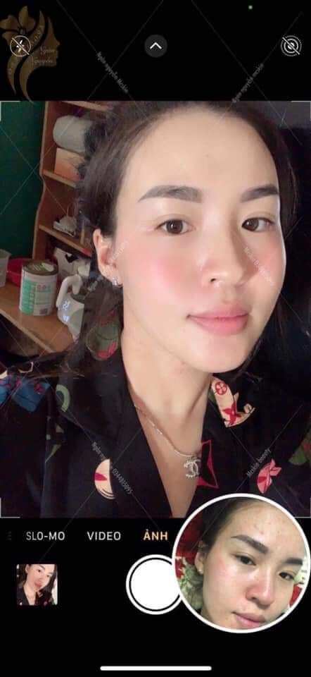 (1 chai)Tinh chất Tái tạo da hồng sâm MC_SKIN (chínhhãng).