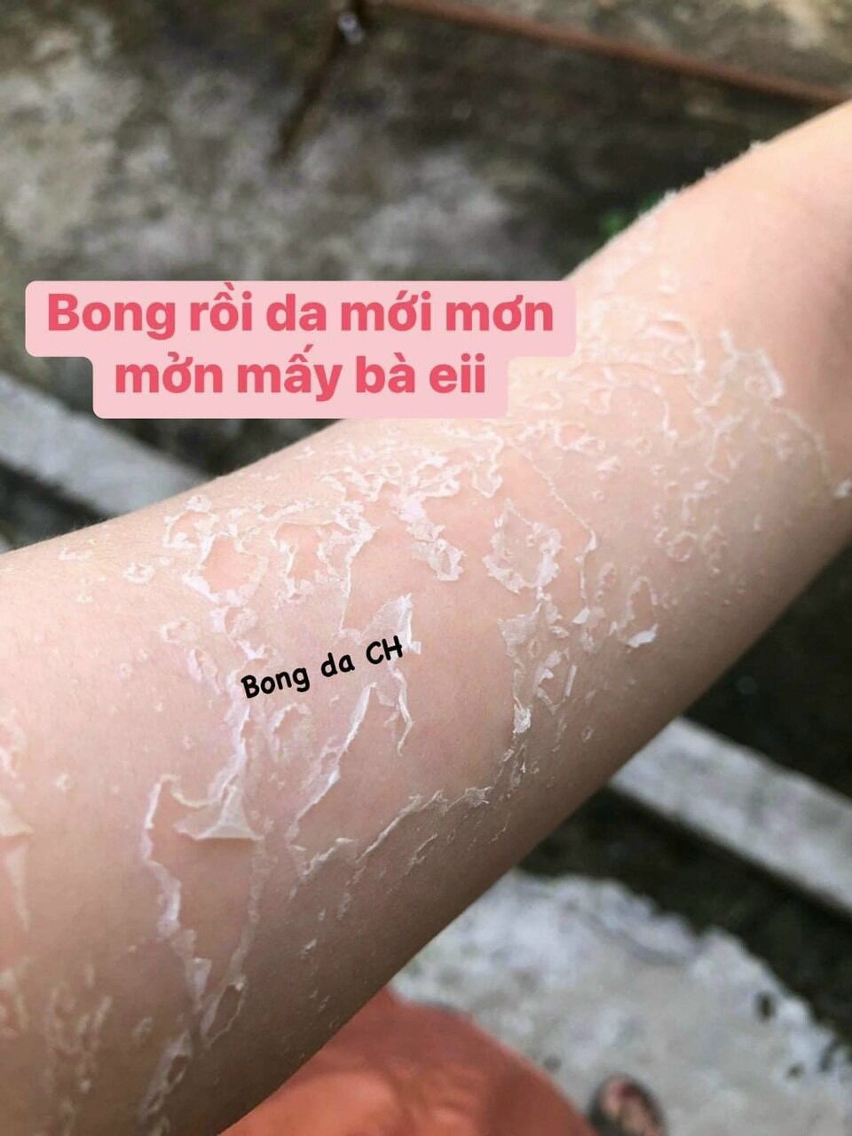 Peel Da Body Trắng Cấp Tốc