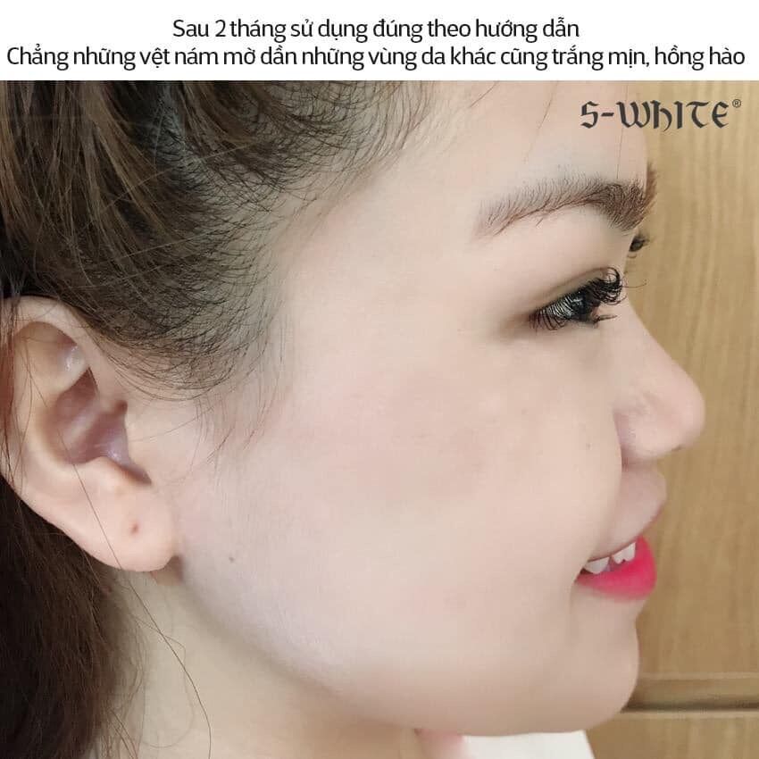 [HCM]Kem nám Swhite ban đêm date mới