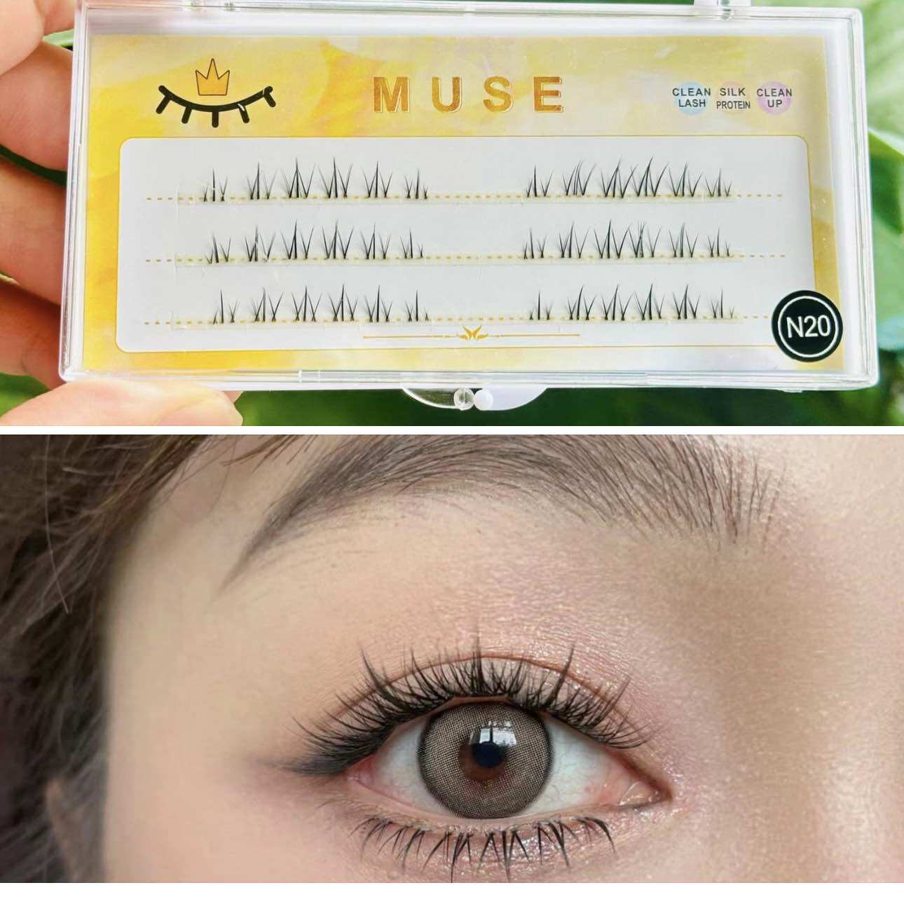 Mi dưới cụm n20