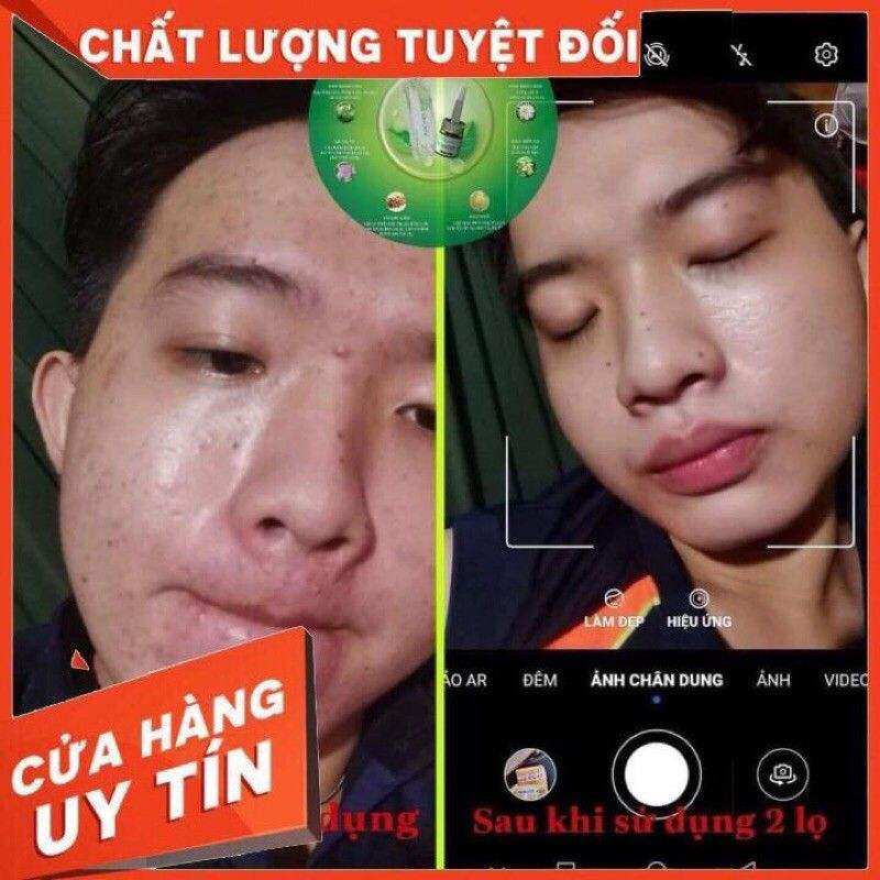 thảo mộc xanh chính hãng