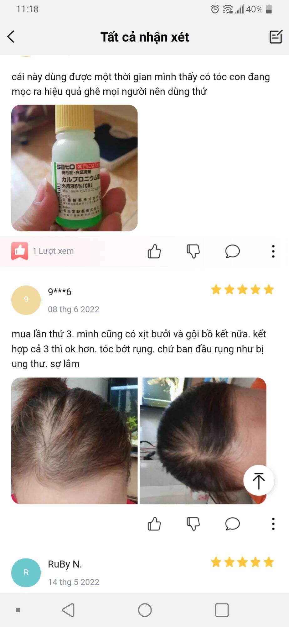【HCM 】Mọc tóc Sato , mọc tóc Jg Nhật 30ml hàng bệnh viện