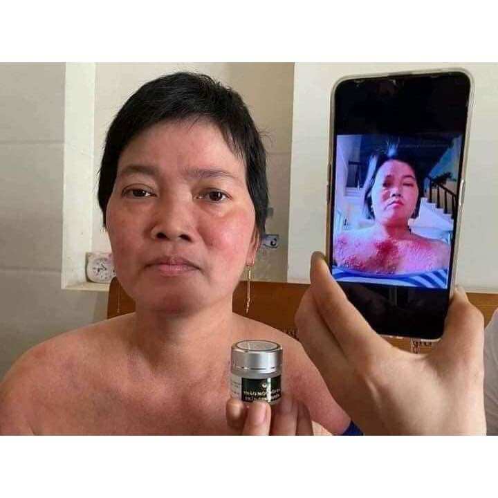 THẢO MỘC BÔI DA TRẦN KIM HUYỀN