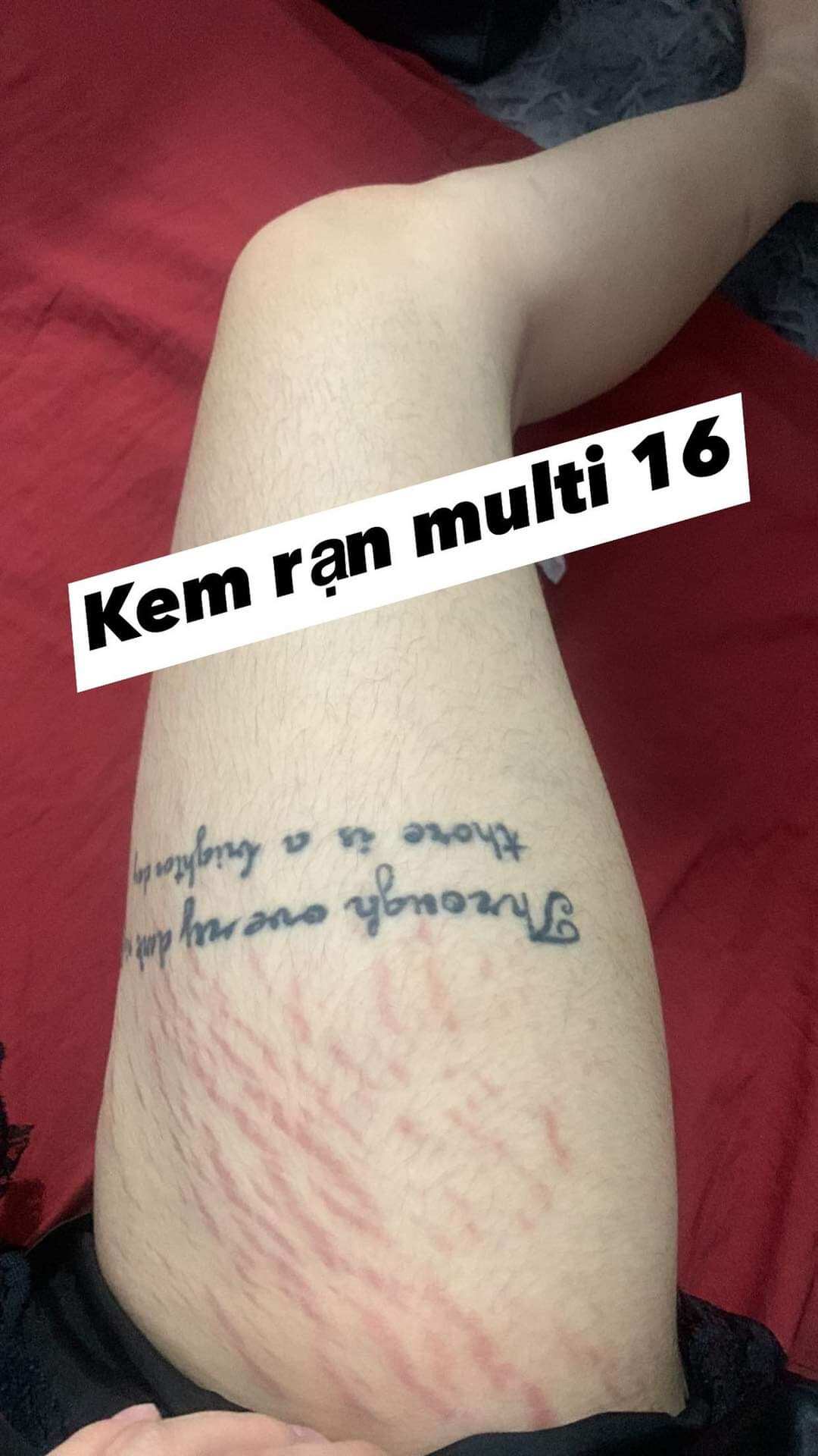 Combo 20 hũ kem Multi 16 loại 20g