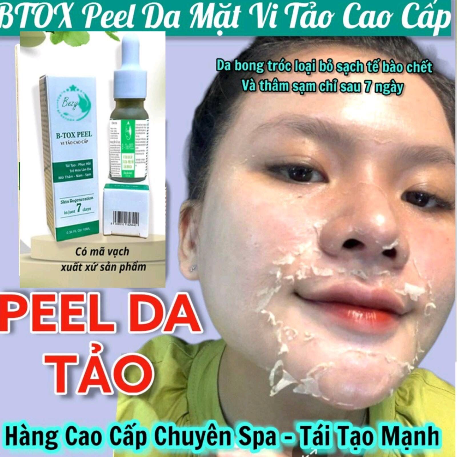 Peel bong da vi tảo sạch nám trắng da sau 7 ngày