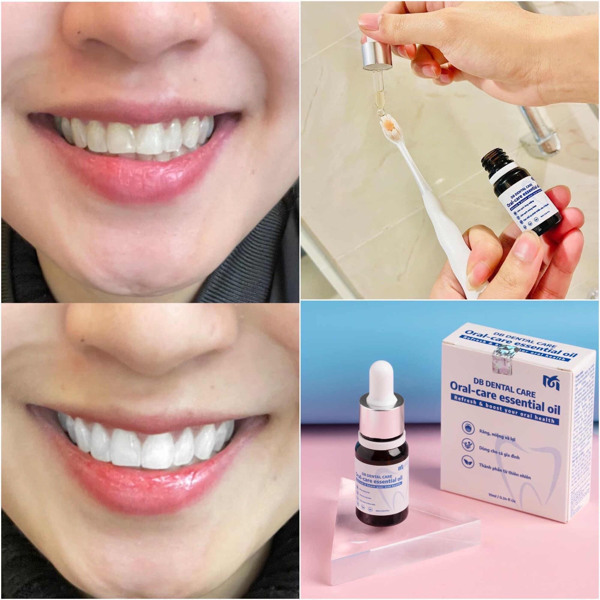 Tinh dầu răng miệng DB Dental Care 10ml [combo 2 lọ]