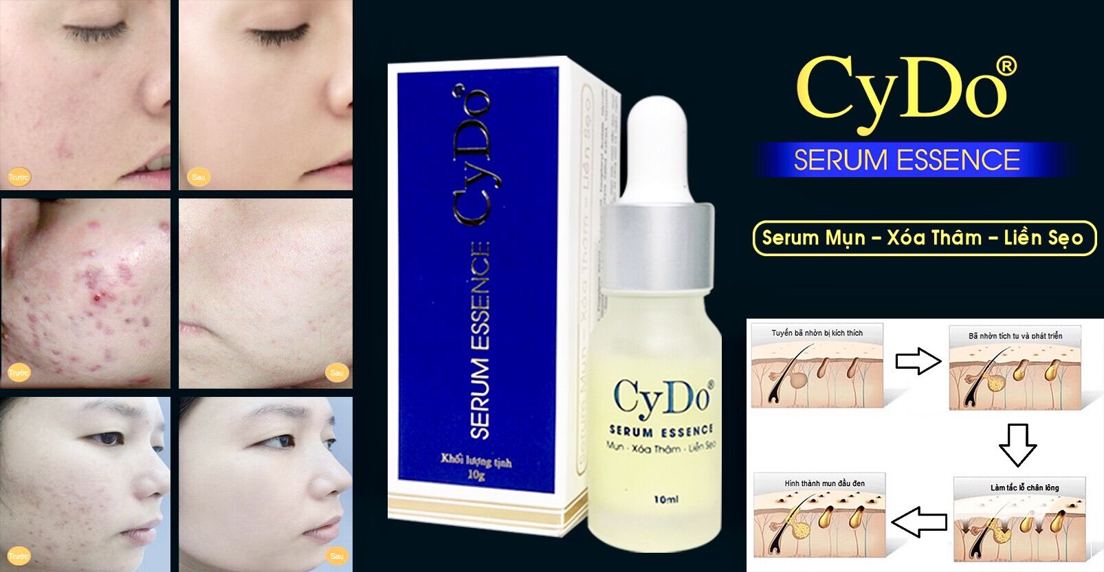 [HCM]SERUM CYDO ESSENCE MỤN XOÁ THÂM MỜ SẸO 10ML