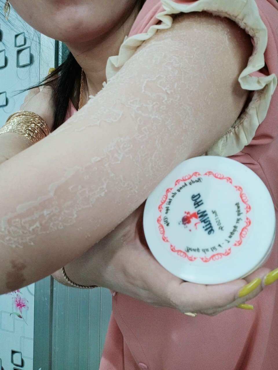 Kem Bong Da Kích Trắng