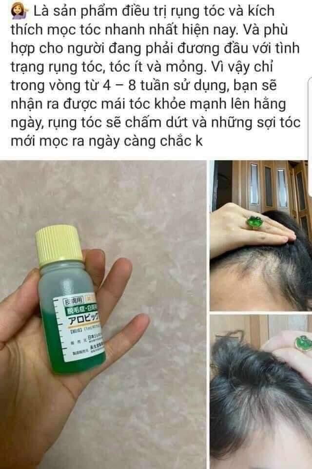 Serum mọc tóc ,hói đầu Sato