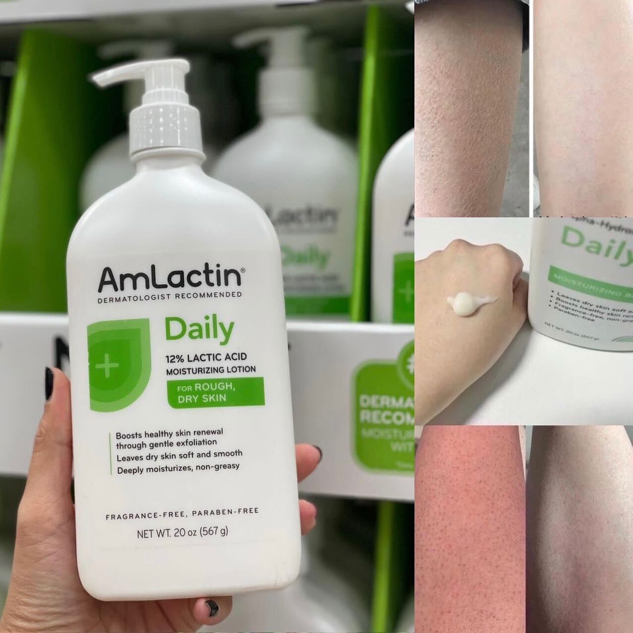 Kem Dưỡng Ẩm Toàn Thân Amlactin Daily Body Lotion 567g