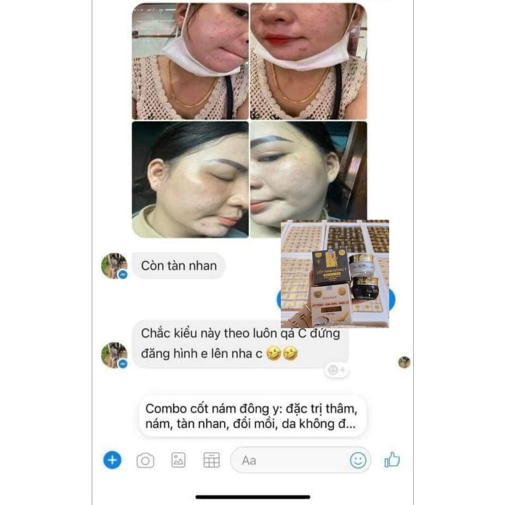 (MẪU MỚI) Cốt Nám Đông Y Nicos (Chính Hãng 100%)