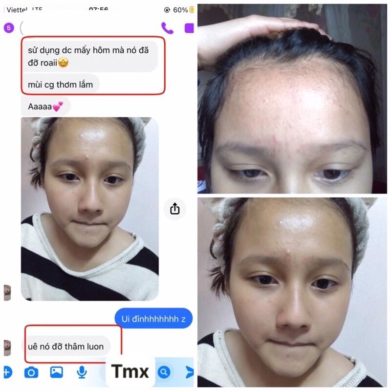 [Freeship] Serum Thảo Mộc Xanh 5ml