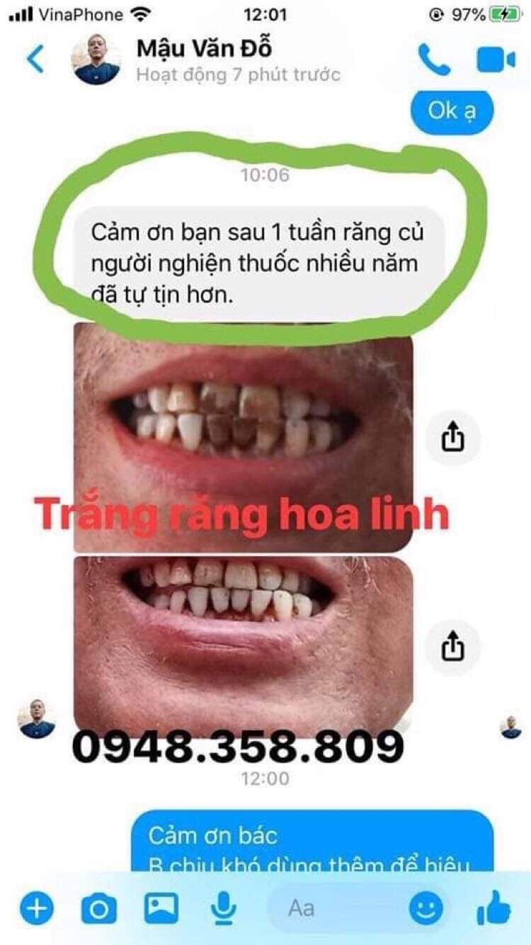 Gói dùng thử bột đánh trắng răng 100gam