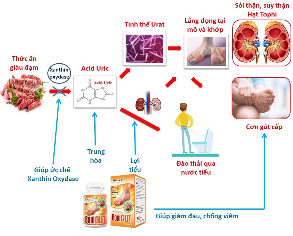 BONIGUT_ hỗ trợ bệnh gut