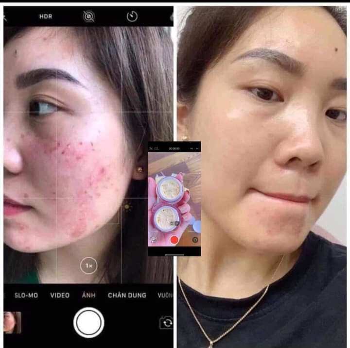 Kem Face Ngọc Oanh
