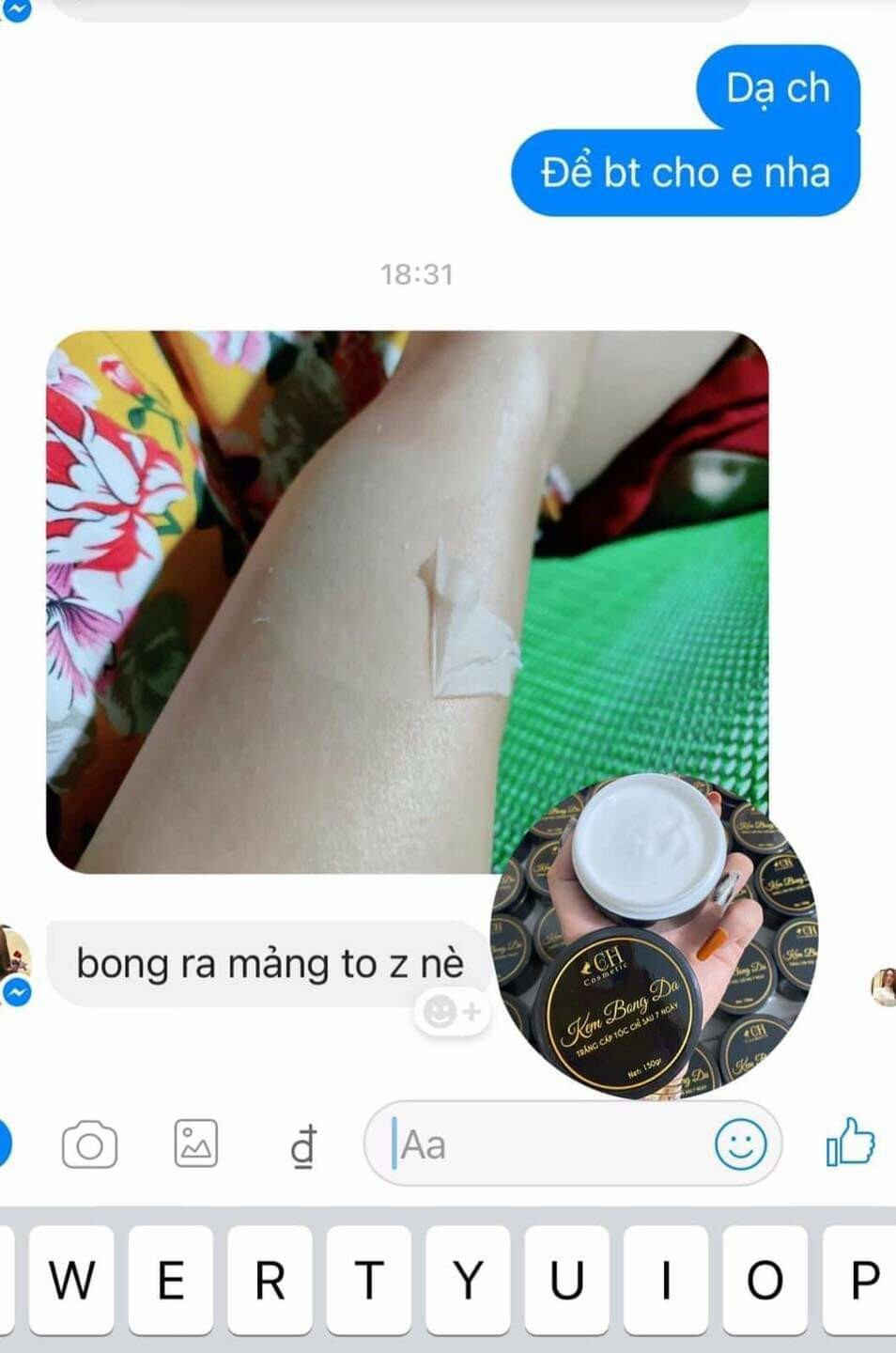 Body Bong Da CH Trắng Cấp Tốc Sau 7 Ngày