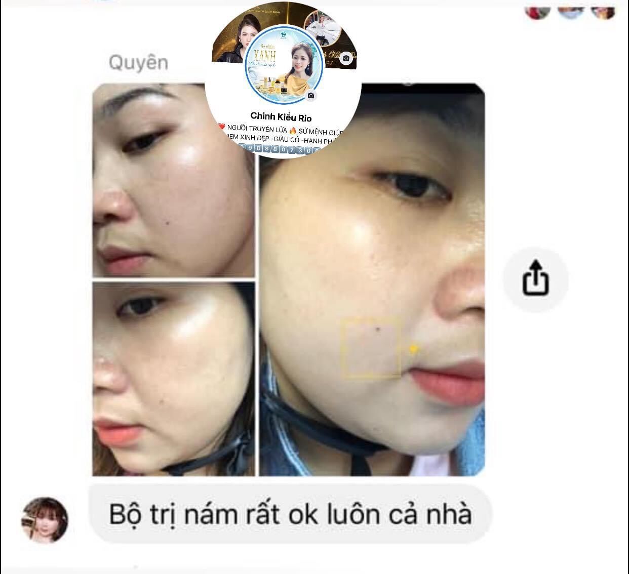 VUA NÁM NGHỆ COLLAGEN BAN NGÀY
