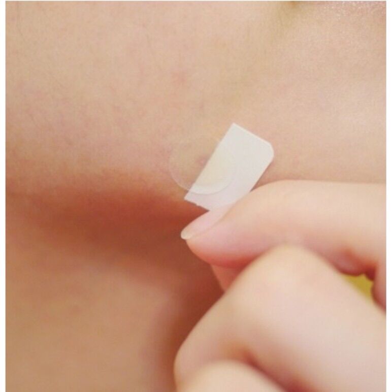 Miếng dán mụn dùng cho ban đêm (12 miếng) DERMA ANGEL