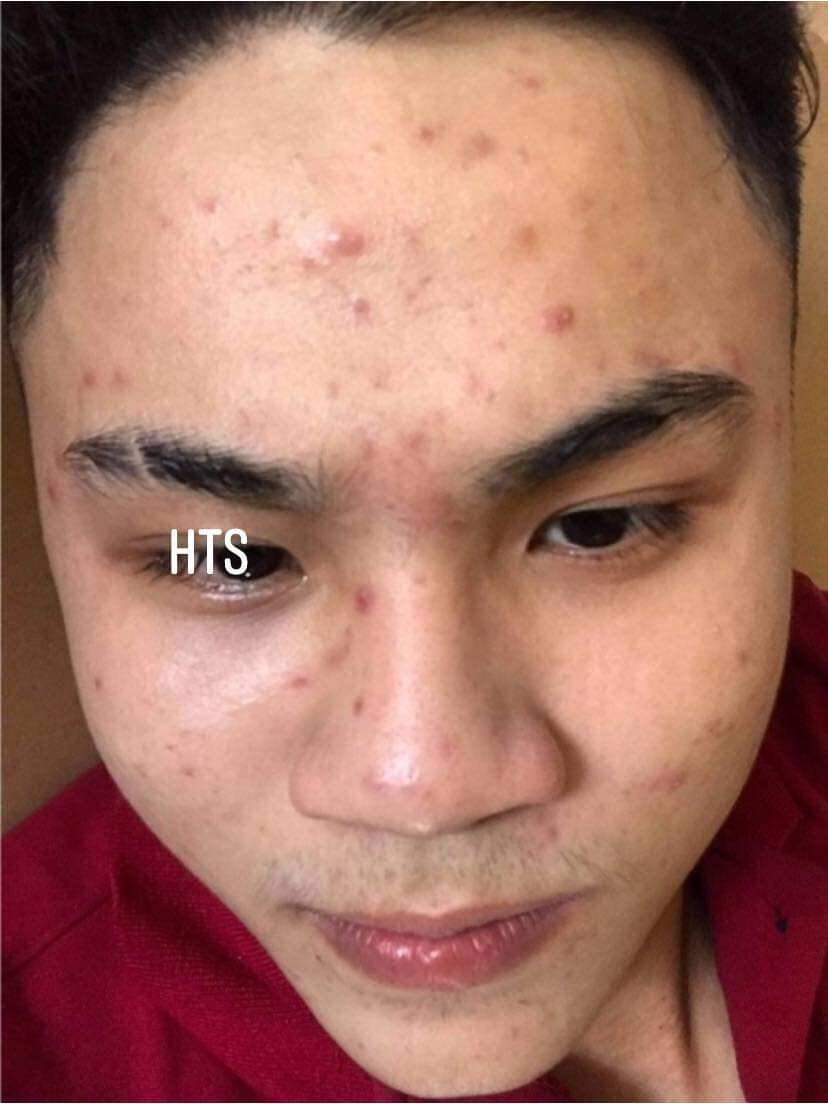 tinh chất Hoàng Thiên Sâm (loại mạnh)
