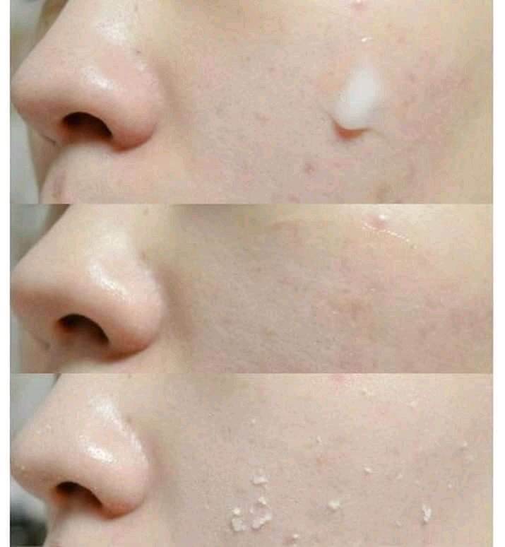 Gel tẩy tế bào chết nhân sâm Arrahan Hàn Quốc