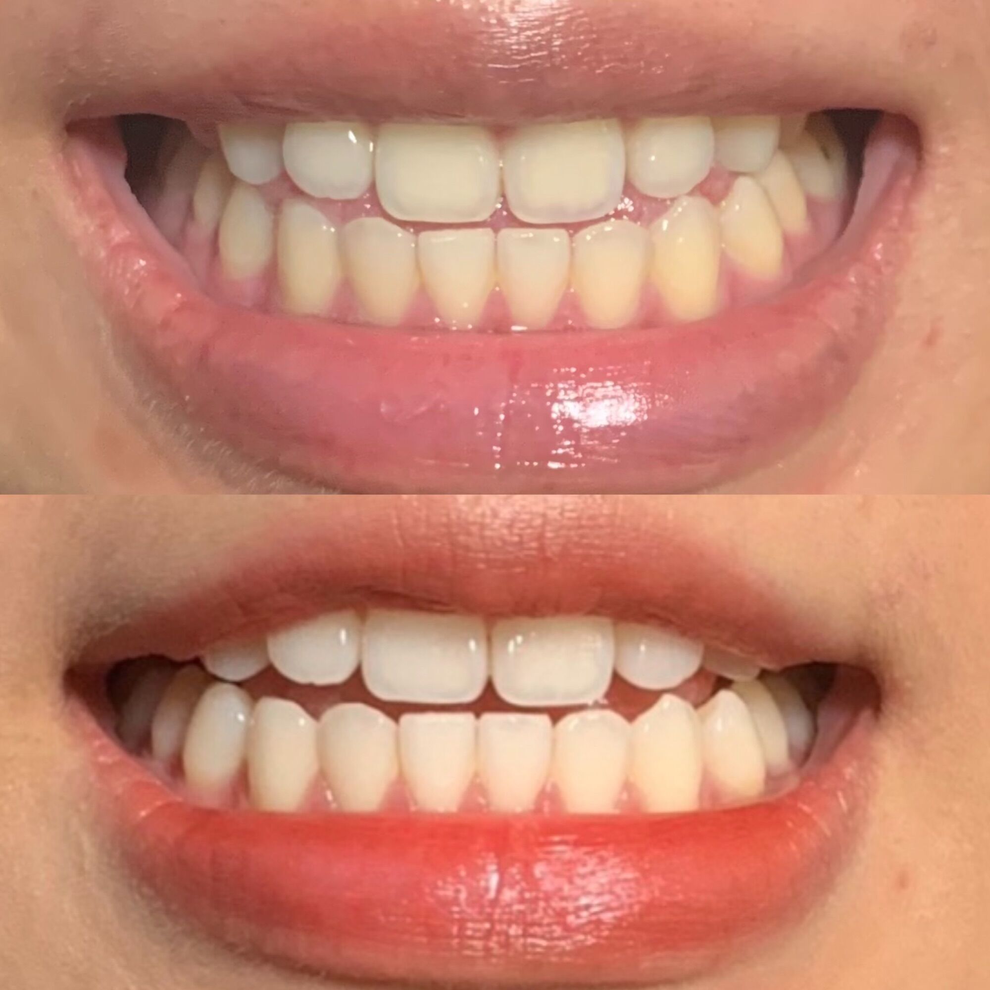 [HCM]Bột Đánh Trắng Răng Thơm Miệng BRIGHT TOOTH POWER Chính Hẵng