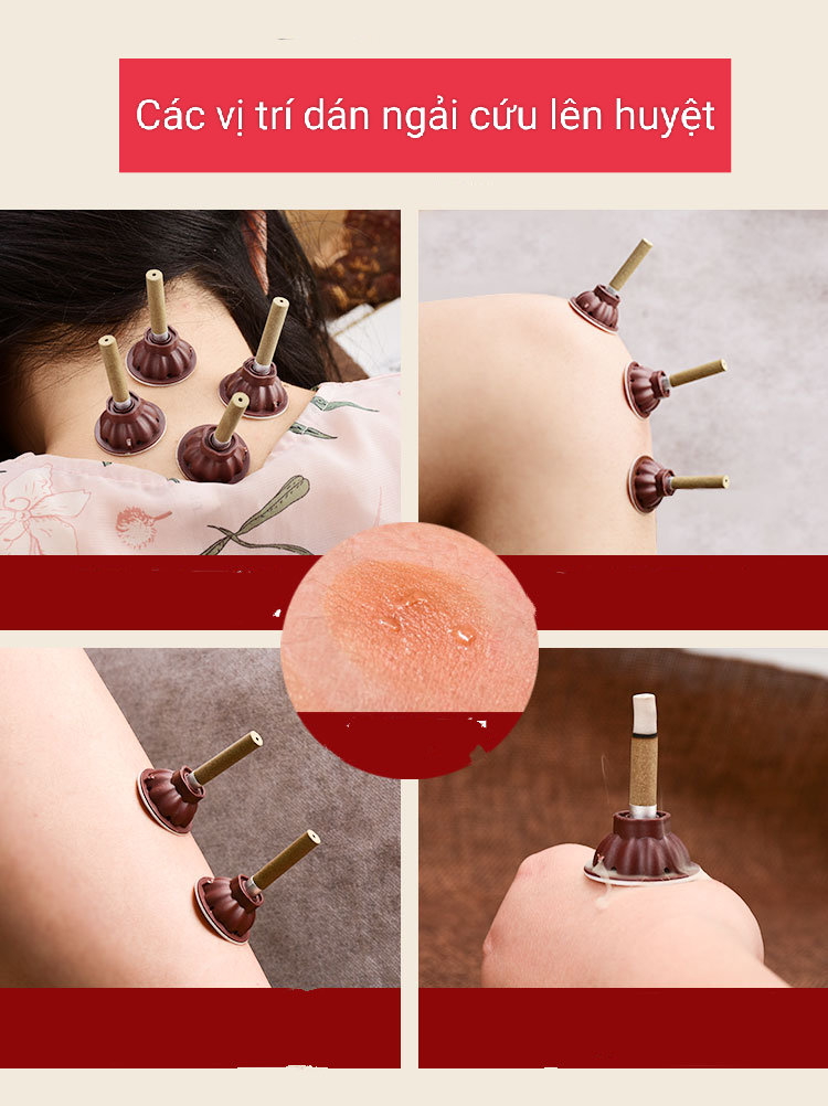 Set 50 nhang ngải dán, điếu ngải cứu dán cao cấp kèm đế dán. Phương pháp châm cứu ấm bằng nhang ngải cứu dán