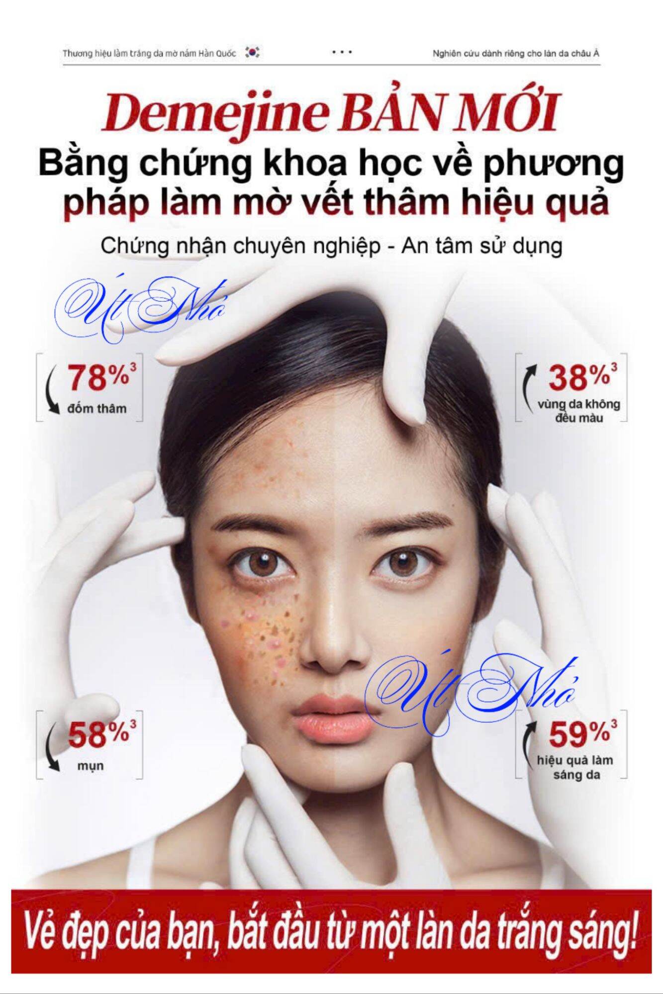 Kem nám DN Demejine , kem Hàn Quốc, kem dưỡng trắng da , mờ nám