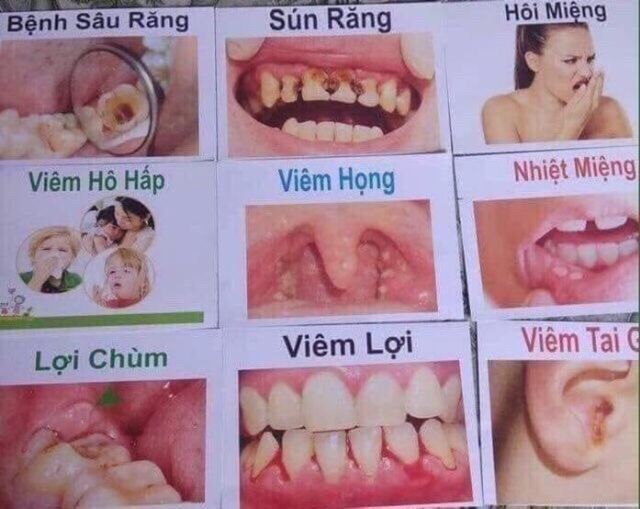 Tinh Dầu Răng Miệng Dạ thảo Liên 20ml