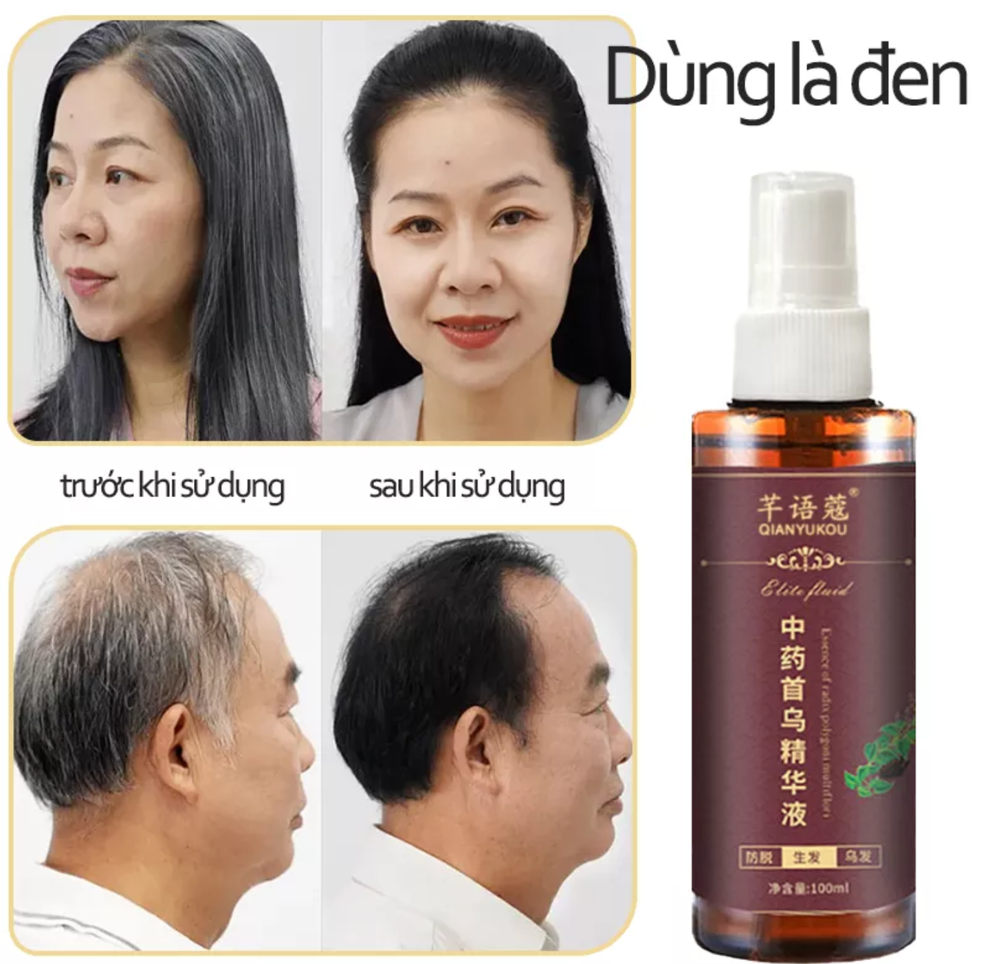 CHAI XỊT ĐEN TÓC DƯỠNG TÓC CAM KẾT HIỆU QUẢ HÀNG LOẠI TỐT