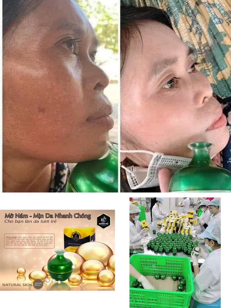 combo nám  huỳnh đỗ
