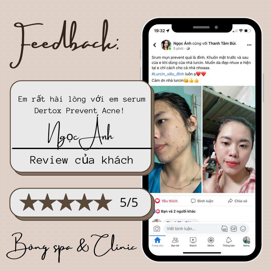 Serum mụn DETOX PREVENT ACNE