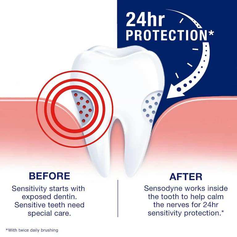 [HÀNG NỸ CHÍNH HÃNG] Kem đánh răng làm trắng Sensodyne Extra 1 tuýp 184g