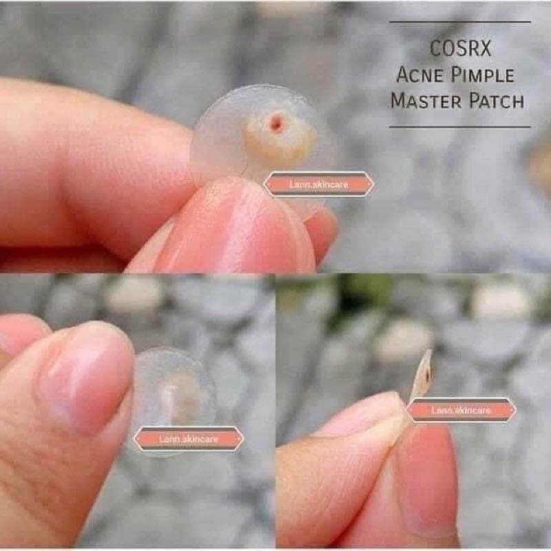 Miếng dán mụn Cosrx Acne Pimple Master Patch bịch 24 miếng (pack of 24pcs)
