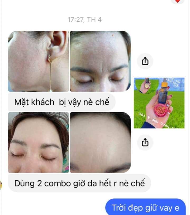 Bộ đôi Kem Face Ngọc Oanh