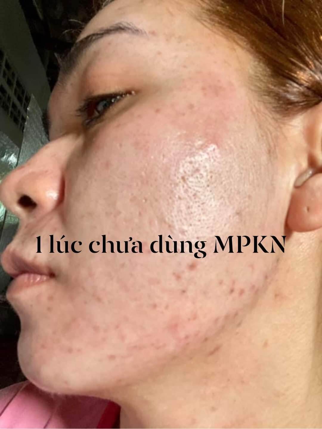 Kem face đa chức năng Kim Nhung Spa